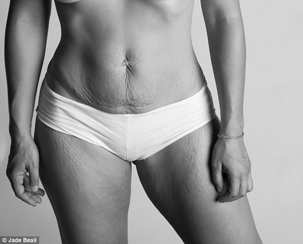 Hình ảnh chân thực về cơ thể của người phụ nữ sau khi sinh 8