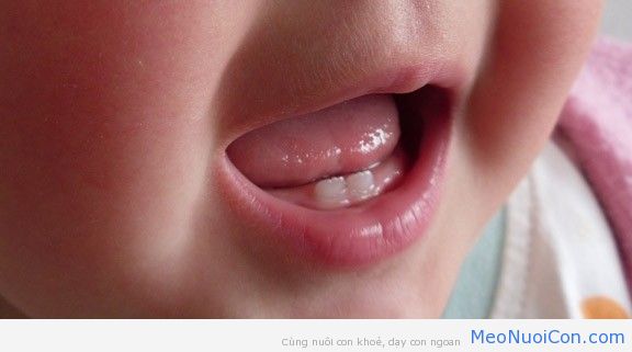Chăm sóc răng miệng đúng cách cho trẻ 0 – 18 tháng