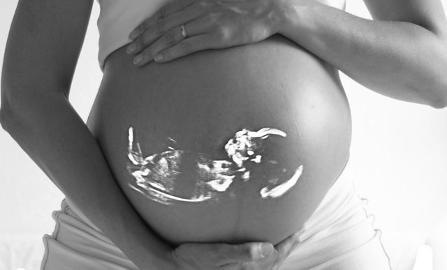 Những điều không bình thường về thai nhi 90% mẹ bầu chưa biết