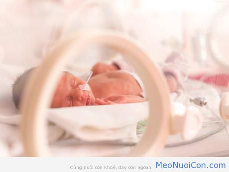 Em bé sinh non 22 tuần bất ngờ cử động sau khi bác sĩ thông báo đã tử vong