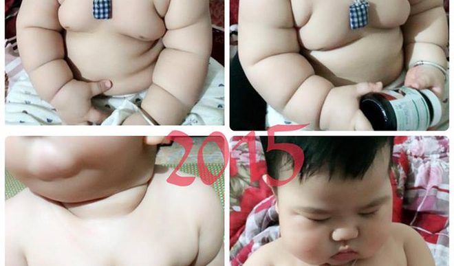 Cậu bé bú sữa mẹ hoàn toàn, 8 tháng nặng 16kg, tay chân đầy ngấn