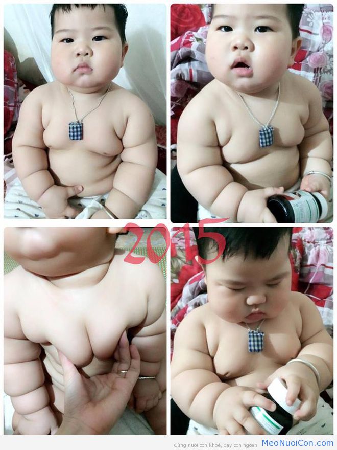 Cậu bé bú sữa mẹ hoàn toàn, 8 tháng nặng 16kg, tay chân đầy ngấn - Ảnh 1.