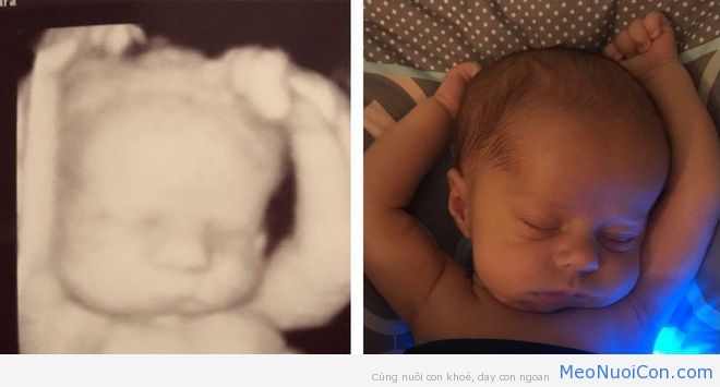 Dân mạng phấn khích với hình ảnh bé 3 tuần tuổi có tư thế ngủ y hệt lúc nằm trong bụng mẹ