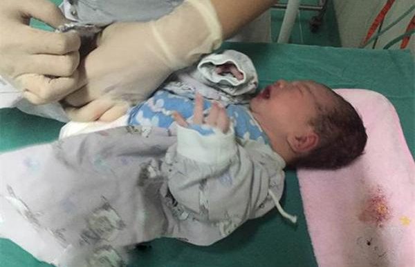Thai nhi 7 tháng giảm chuyển động, bác sĩ choáng váng khi mổ cấp cứu lấy thai