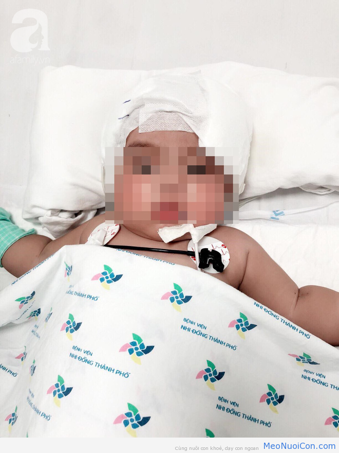 Phòng khám tư chẩn đoán nhầm viêm màng não là sốt siêu vi, bé gái 6 tháng tuổi rơi vào nguy kịch - Ảnh 1.