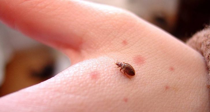 4 bước xử lý chuẩn bác sĩ khi trẻ bị côn trùng cắn bố mẹ cần biết